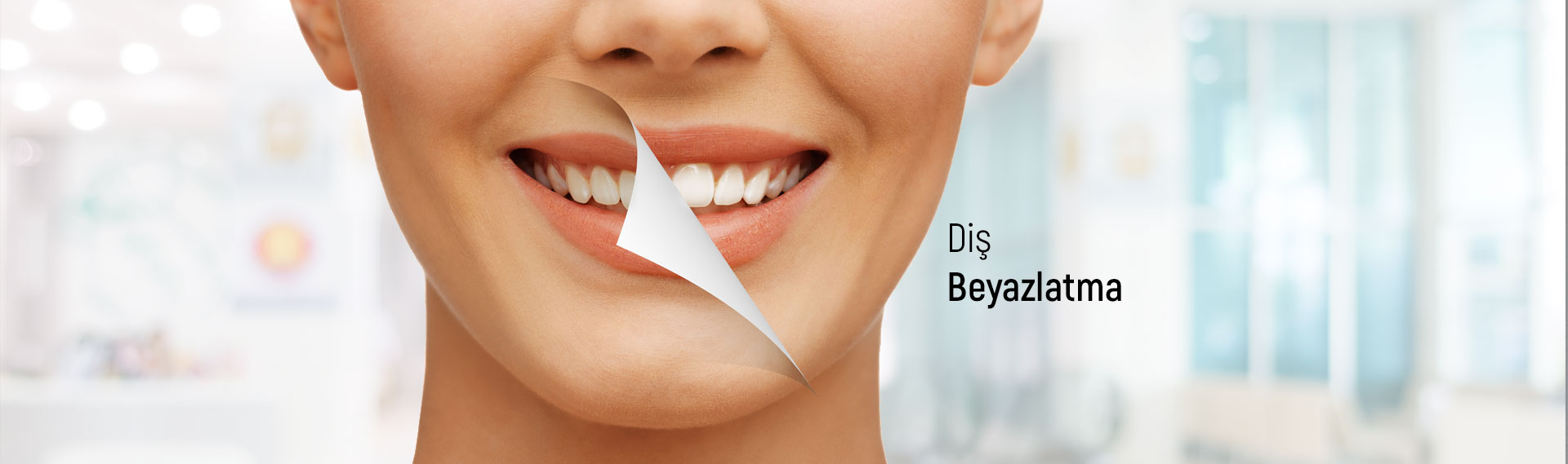 .Diş Beyazlatma